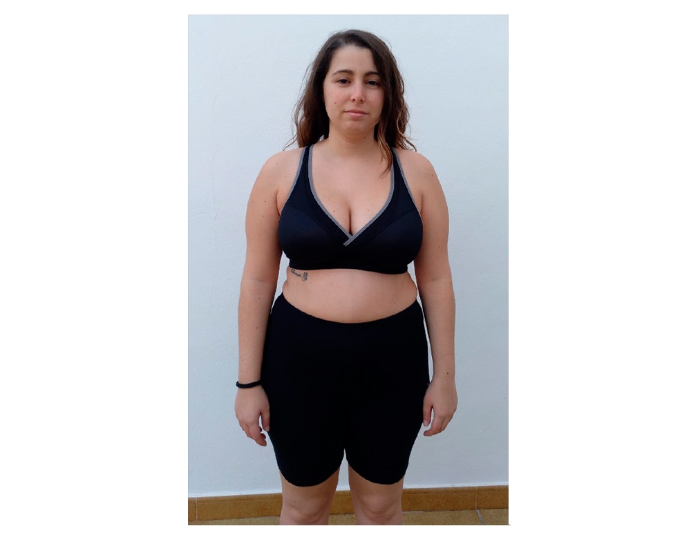 Antes del tratamiento