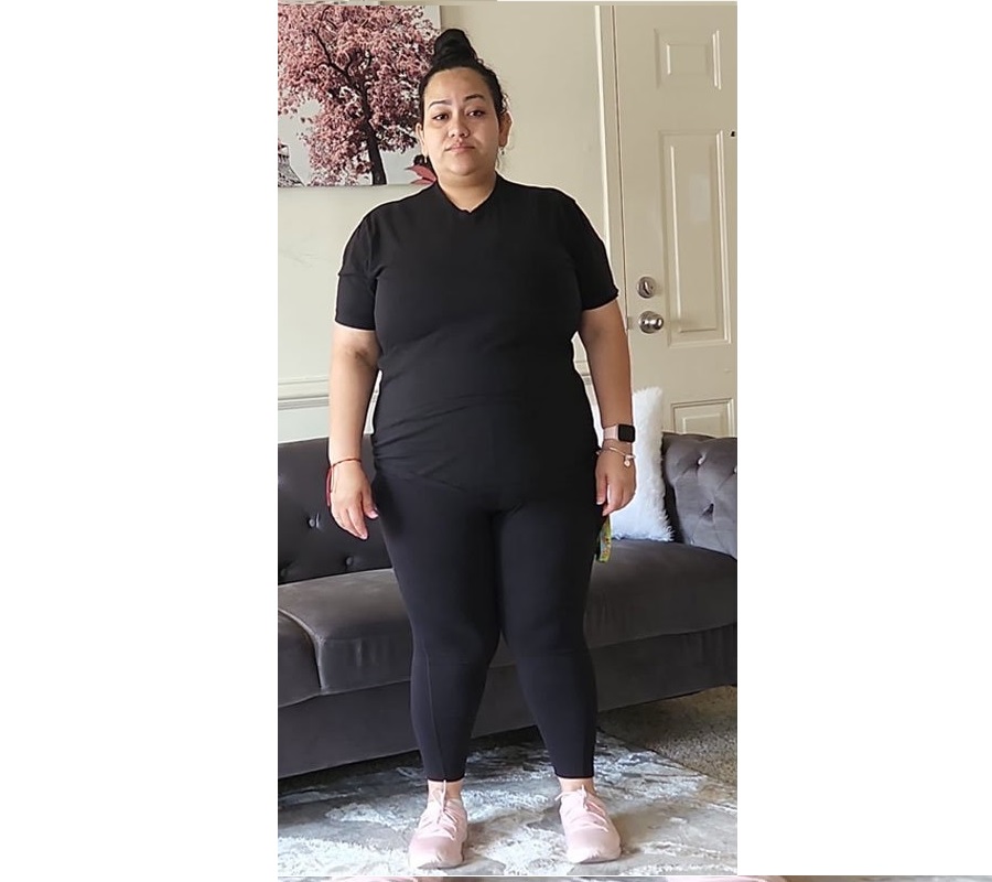 Antes del tratamiento